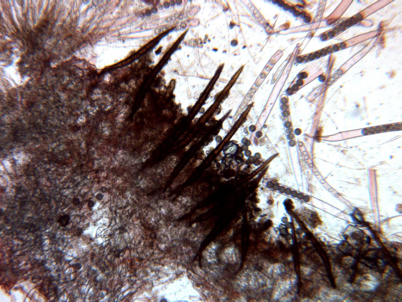 Microscopía de Scutellinia trechispora - 10 - Pelos x 100